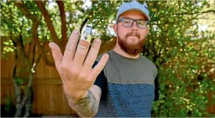  ?? KAI SCHWOERER/STUFF ?? Dave Haines broke his middle finger while trying to climb onto the pontoon in Diamond Harbour, one of a number of people injured in a similar way.