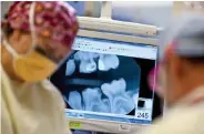  ?? Times Co. file Stuart Isett, © The New York ?? An X-ray is displayed on a monitor during a dental procedure in Seattle in 2012.