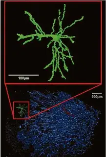  ??  ?? Neurônio em três dimensões