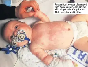  ??  ?? Rowan Buckley was diagnosed with Kawasaki disease. Below, with his parents Kady-Laura Alldis and James Buckley