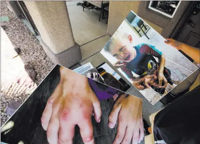  ?? Chase Stevens ?? Las Vegas Review-journal @csstevensp­hoto Brandon Hulet holds photos Thursday of his son, Mason, pictured after being stung by a bee, that were shown at a recent Henderson City Council meeting. Mason has been stung by bees multiple times in the family’s backyard.