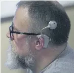  ??  ?? Cochlear implant sits behind the ear