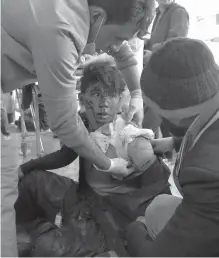  ?? AGENCE FRANCE PRESSE ?? Afghan medical staff treat a wounded boy, after a car bomb exploded near the old Interior Ministry building, at Jamhuriat Hospital in Kabul.