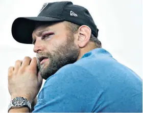  ??  ?? Gruesome: New Zealand’s Joe Moody can barely see out of his left eye