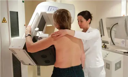  ?? Photograph: Alamy Stock Photo ?? Secondary breast cancer occurs when the cancer spreads to other parts of the body.