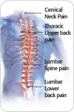  ??  ?? Cervical Neck Pain Thoracic Upper back pain
Lumbar Spine pain
Lumbar Lower back pain