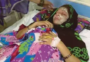  ??  ?? FARAH yang mengalami kecederaan
pada muka dirawat di sebuah hospital di Moradabad di negeri
Uttar Pradesh, India. - Agensi