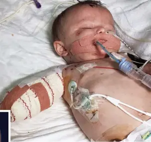  ??  ?? Fighting for life: Ten-month-old Kia after her arm was amputated