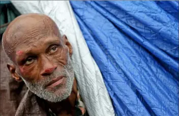  ?? Matt stone / boston herald file ?? a bruised, battered Wendell Wilson sticks his head out of his tent last month knowing he needs to vacate the area of the methadone mile.