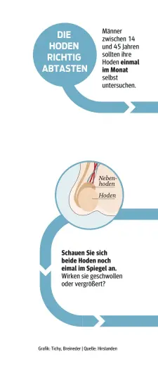 Größer als rechter linker nebenhoden Hoden ist