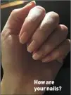 ??  ?? How are your nails?