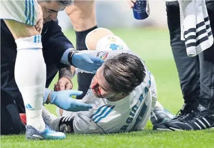  ??  ?? Una brutal patada de Lucas en el rostro de Sergio Ramos le provocó fractura de nariz.