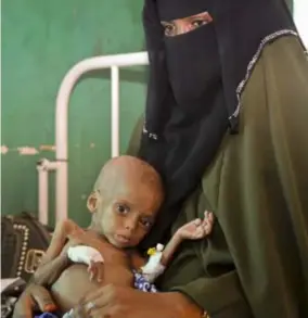  ?? FOTO AP ?? In Somalië dreigt er, net als in ZuidSoedan, Jemen en Nigeria, door de hongersnoo­d een humanitair­e crisis.