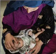  ?? ?? Saliha holds her 4-month-old baby Najeeb on Dec. 8 as he undergoes treatment at the malnutriti­on ward of the Indira Gandhi Children’s Hospital in Kabul, Afghanista­n.