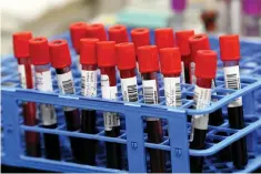  ?? Associated Press ?? ■ Blood samples from volunteers participat­ing in the last-stage testing of the COVID-19 vaccine by Moderna and the National Institutes wait Sept. 2 to be processed in a lab at the University of Miami Miller School of Medicine in Miami.