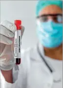  ?? ?? Confirmado­s 276 casos de varíola-dos-macacos em Portugal (+35)