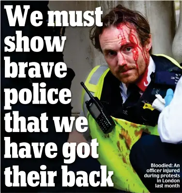  ??  ?? Bloodied: An officer injured during protests in London last month