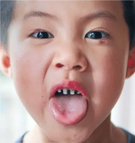  ?? Photo: Michael Bradley/fairfaxnz ?? Mind the gaps: Angelo Li and Grace Simpson (pictured with mum Natalie) have both tried to look after their teeth but have suffered from tooth decay.