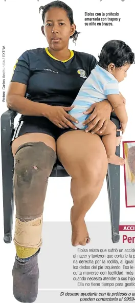  ??  ?? Eloísa con la prótesis amarrada con trapos y su niño en brazos.