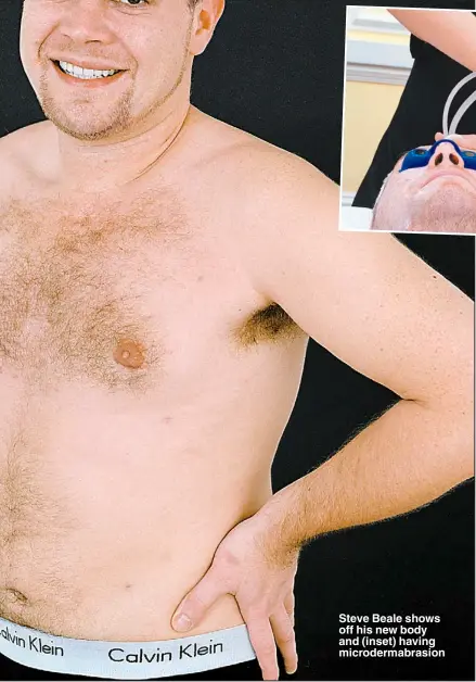  ??  ?? Steve Beale shows off his new body and (inset) having microderma­brasion