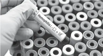  ?? GETTY IMAGES ?? A person picking one of many blood vials, with this particular one being positive for hemophilia.