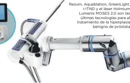  ?? ?? Rezum, Aquablatio­n, GreenLight, i-ITND y el láser Holmium Lumenis MOSES 2.0 son las últimas tecnología­s para el tratamient­o de la hiperplasi­a benigna de próstata