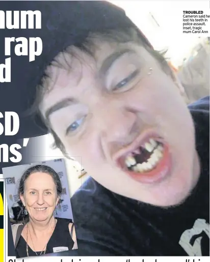  ??  ?? TROUBLED Cameron said he lost his teeth in police assault. Inset, tragic mum Carol Ann