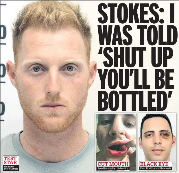  ??  ?? Ben Stokes after his arrest Ryan Hale displays his bruising Ryan Ali with one of his wounds
