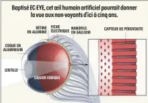  ??  ?? Baptisé EC-EYE, cet oeil humain artificiel pourrait donner la vue aux non-voyants d’ici à cinq ans.