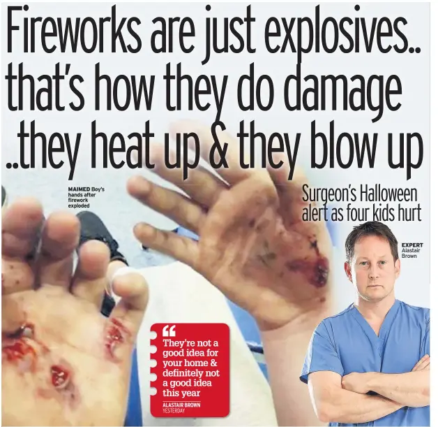  ??  ?? MAIMED Boy’s hands after firework exploded
EXPERT Alastair Brown