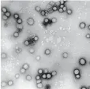  ?? FOTO: LEHTIKUVA/HANDOUT/ARKIV ?? Så här ser ett influensav­iruset A ut.