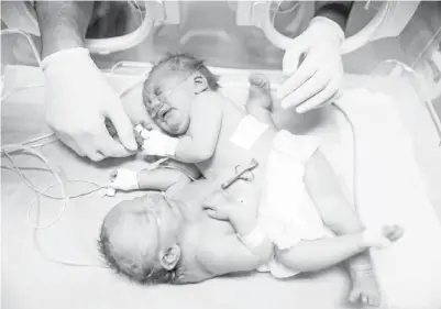  ?? — Gambar AFP ?? KEMBAR siam Palestin yang baharu sehari dilahirkan ditempatka­n dalam inkubator di nurseri Hospital al-Shifa di Kota Gaza, kelmarin.