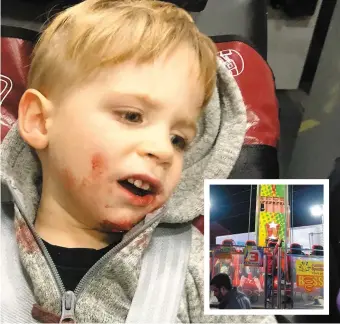  ?? PHOTO COURTOISIE ?? Aiden Bellemare, 3 ans, dans l’ambulance, après être tombé du manège qui simule une chute avec la gravité (en mortaise), lors d’un festival à Sainte-Adèle.