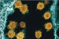  ?? NIAID — NATIONAL INSTITUTES OF HEALTH VIA THE ASSOCIATED PRESS ?? Novel Coronaviru­s SARS- CoV-2 virus particles, orange, isolated from a patient.