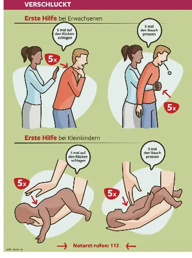 Wie Eltern Ihr Kind Vor Dem Ersticken Retten Pressreader