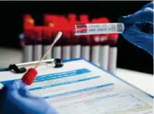  ?? FOTO: MOSTPHOTOS ?? PCR-TEST. PCR-testerna vid företagets mottagning­ar och labb kan ha varit rena bluffen.
