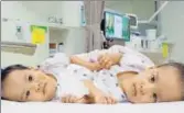  ?? AP ?? Two 15monthold girls before surgery at the Royal Children's Hospital Melbourne, Australia. Surgeons successful­ly separated the Bhutanese conjoined twins on Friday.