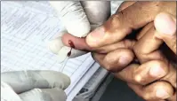  ?? PICTURE: AP ?? TELL-TALE SIGN: A finger-prick drop of blood is added to a disposable strip and inserted into a hand-held reader which displays purine levels.