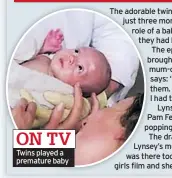  ??  ?? ON TV Twins played a premature baby