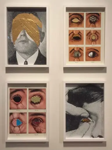  ?? COURTESY OF THE AGA KHAN MUSEUM ?? Jaret Vadera’s Diseases of the Eye series uses medical illustrati­ons as a metaphor for the removal of “foreign bodies.”