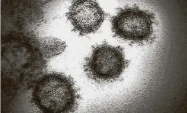  ?? National Institute of Allergy and Infectious Diseases / Tribune News Service ?? This transmissi­on electron microscope image shows the virus that causes COVID-19, isolated from a patient in the U.S., emerging from the surface of cells cultured in the lab.