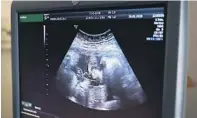  ?? ILLUSTRASJ­ONSFOTO: NTB SCANPIX ?? NY DEBATT OM ABORTLOVEN: Det er et viktig prinsipp at vi ikke bør ha lover som gjør at noen mennesker anses som mer eller mindre verdifulle enn andre, skriver Karoline Aarvold fra Skien Unge Høyre.