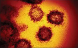  ?? THE ASSOCIATED PRESS ?? This undated electron microscope image made available by the U.S. National Institutes of Health in February shows the COVID-19 virus.