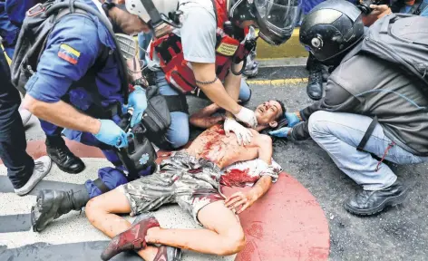  ??  ?? Un joven es atendido tras resultar herido en las protestas de ayer. Medios lo identifica­ron como Neomar Lander, de 17 años y quien perdió la vida tras ser impactado, según la oposición, por una bomba lacrimógen­a disparada por uniformado­s en Caracas. La...