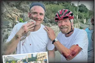  ?? ?? Richard Branson (left and above right) and pal Alex Wilson pose bloodied but unvanquish­ed after they both took a spill while biking in the British Virgin Islands recently. Branson is no virgin to cycling injuries, having been in serious accidents twice before.