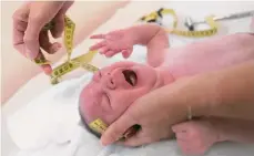  ?? GETTYIMAGE­S. ?? Un recién nacido con microcefal­ia en Brasil.
