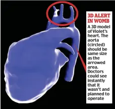  ??  ?? 3D ALERT IN WOMB A 3D model of Violet’s heart. The aorta (circled) should be same size as the arrowed area. Doctors could see instantly that it wasn’t and planned to operate