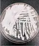  ?? SHAWN LOCKHART/CDC ?? A strain of the infection
is cultured in a petri dish at the CDC.