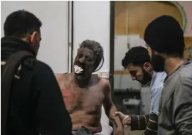  ??  ?? A man receives medical attention after air strikes hit the city of Mesraba, near Damascus. At least 28 people were reported killed in air raids by forces loyal to the Syrian government