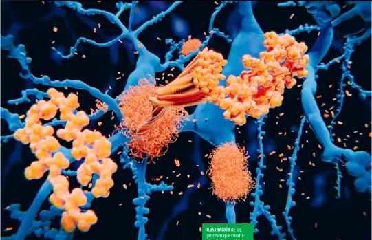  ??  ?? ILUSTRACIÓ­N de los procesos que conducen a la formación de placas de beta-amiloide (haces enredados) en las neuronas (en azul). La acumulació­n descontrol­ada de dichas proteínas es caracterís­tica del alzhéimer.